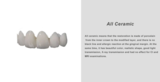 All Ceramic Tooth